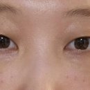 인트로성형외과의원 이미지