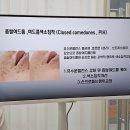 율림교로 | 마산여드름관리 조엘랑더마랩, 반복 여드름 상담받은 후기