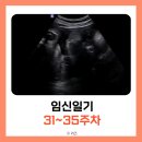 서대문구보건소 별관 | [임신 31-35주차] 임신 후기 증상, 붓기, 손가락 저림, 서대문구 보건소 백일해주사 접종, 코엑스...