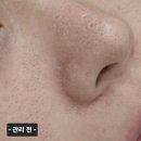 뽀샤시 - 전주시 완산구 거마중앙로 17 | 부평 모공관리 에스테틱채로 뽀샤시한 후기