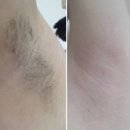 네일블라썸 이미지