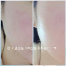 어펙션룸 | 송정동피부관리 경기광주 어펙션룸 수분관리