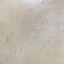 탈스테이 | 탈스 아크닉 수딩 세럼 여드름피부용화장품 써봤어요~