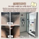 레모니홈 | 머리 묶을 때마다 휑해서 신경 쓰였다면? 인천 SMP 탈모 커버, 설레인라인 방문기!