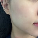 (주)준메디케어 | 부평피부관리 추천│피부 트러블부터 피부결,광, 모공까지 케어하는 '데자뷰메디스킨 인천점' 솔직후기