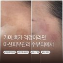 CU(마산구산수정점) | 마산 기미 걱정이라면 교방동피부관리 수뷰티 에서 깨끗하게 지우기