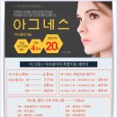 아그네스