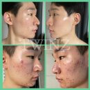 뉴스킨케어 이미지