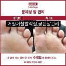 베어수