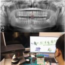 미소치과기공소 이미지