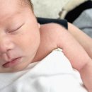 권소아과의원 | 이천 보건소 BCG접종 피내용 예약방법, 준비물, 후기