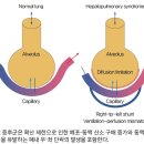 심신불안 도움주는 &#39;산조인탕&#39; 두통에도 도움 두통 있고 두중감 있으면 시호가용골모려탕 적용 이미지