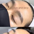 아이앤라나