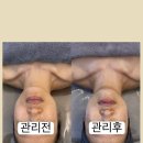선 에스테딕 네이버블로그