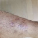 오피부과의원 이미지