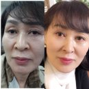인셀덤창원대리점 | 인생화장품 #인셀덤 바르고 피부과 끊었어요 ^^