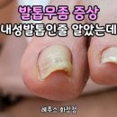 레푸스 화정점 이미지