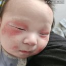 이아이큐랜드 | 신생아, 영유아, 어린 아이에게 쓰는 피부관리 화장품 추천, 아이큐라 미스트