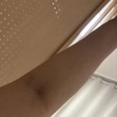 우리척병원 | 쓸개 빠진 넘ㅋ이 됐습니다. / 담낭제거수술 후기 (의정부성모병원 / 담낭제거 로봇수술)