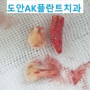 에이케이플란트치과의원 이미지