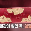 염증 줄이는데 좋은 3가지 음료 이미지