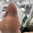 바른네일레푸스 | 수원 인계동 발각질 관리/ 바른네일 레푸스 수원시청점' 후기
