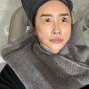 오롯의원 | 흑석동 정착할 곳 드디어 찾다!!!인모드Forma &amp;잡티제거 받은 진심 후기🫦