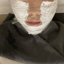 청담포레브의원 | 청담포레브의원 울쎄라 400샷 대만족 후기, 울쎄라 효과 전후