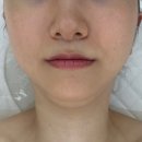 미(美)순환피부 | 김포 피부관리 추천 뷰티하리 김포마산동점 리프팅관리 받고 온 후기 ✨