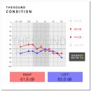 세기 보청기 이미지