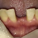 복음치과기공소 이미지