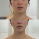 야리2길 | 양산신부관리 윤곽관리 잘하는 곳 이목꾸비에스테틱 후기