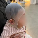 두상교정 비바3D헬멧 상담 및 계약후기