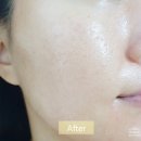 아크메르 프롬 인그리디언트 이너풀 페이스 오일