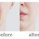 최종원한의원 이미지