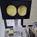 화성독일보청기 | 독일 직수입 최신형 장비로 검사해주는 화성보청기 상담 잘하는 곳