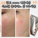 식스6 | 광고 아니고 내돈내산 6주 후기. 식스킨 볼케이노샷 으로 기미 집중공략