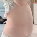 복정해나무한의원 | 다이어트 환 단비단으로 시작한 한약 다이어트, 식욕 조절이 정말 달라졌어요