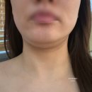 다온에스테틱 | 중랑구 피부관리 쏙프팅 이중턱관리 망우역 다온미에스테틱 후기