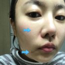 인셀덤고운 | [인셀덤 사업] 인셀덤 제품 후기