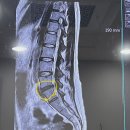 아몽제이 | 내돈내산 허리디스크 통증관리 아이템들 사용후기