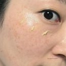 미라클뮤즈 스티바A크림 늘어지는 모공에 사용 해 본 후기