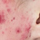 포이즌의원 이미지