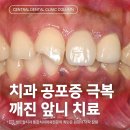 새망미메디칼빌딩 | 수영역치과 공포증, 치료보다 먼저 마음을 살펴야 하는 이유?