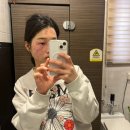 반딧불의원 | 압구정 잡티제거 전문 루나의원 루비레이저 시술후기