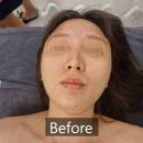 [성남] 위례 더블레스 , 고객중심의 디테일한 럭셔리 케어 위례 피부관리샵