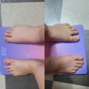 성산한의원 | 다이어트한약 가격 부작용 두달 감량후기 창원다이어트한의원 내돈내산