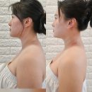 피부이야기 - 대덕구 동춘당로114번길 9 | 호매실 거북목 관리 추천 피부이야기 후기 비포 에프터