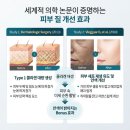 서울정가정의학과의원 | [스컬트라 총정리 ②] 30대 육아맘의 스컬트라 리얼 후기, 얼굴 패임과 안색을 동시에 잡는 법