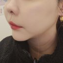 핸드경락 이미지